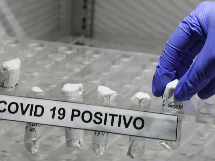 Autoridades sanitarias confirmaron 26 contagios de ómicron en Bogotá
