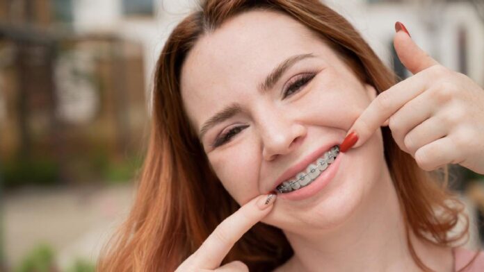 Sonrisa Saludable con Brackets: Cuidado Dental para una Ortodoncia Exitosa