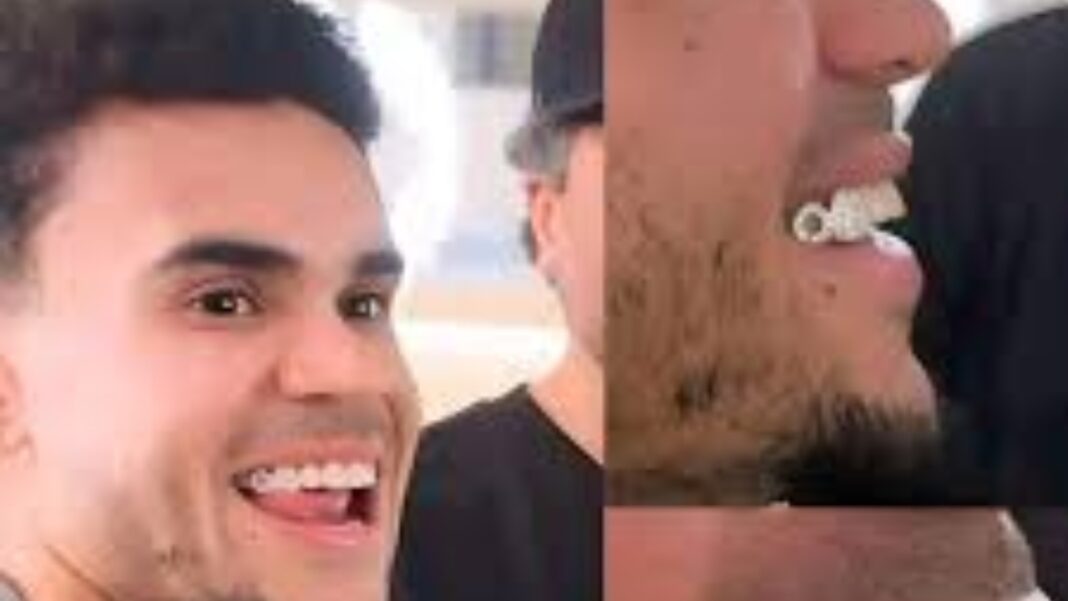 Cuánto vale incrustarse diamantes en los dientes al igual que Luis Díaz