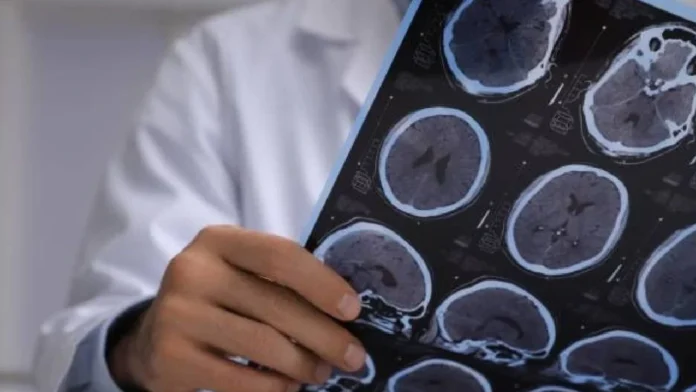 Qué es y qué implica la trauma craneal vestibular, lesión que sufrió Miguel Uribe Qué es y qué implica la trauma craneal vestibular, lesión que sufrió Miguel Uribe