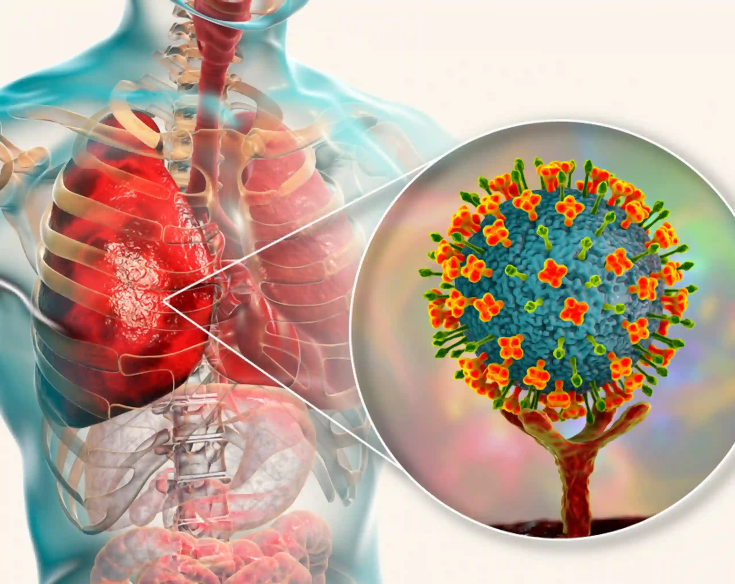 Virus Nipah: Contagio, síntomas, casos y si ha llegado a Latinoamérica 1 Qué es Virus Nipah