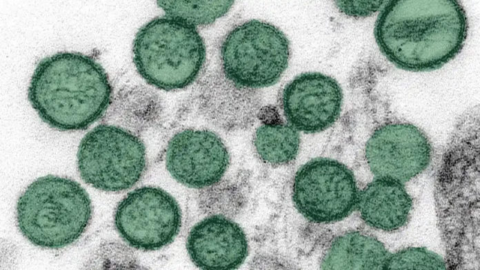 Brote de Hantavirus en Colombia: qué es, contagio, riesgos y dónde están los primeros casos