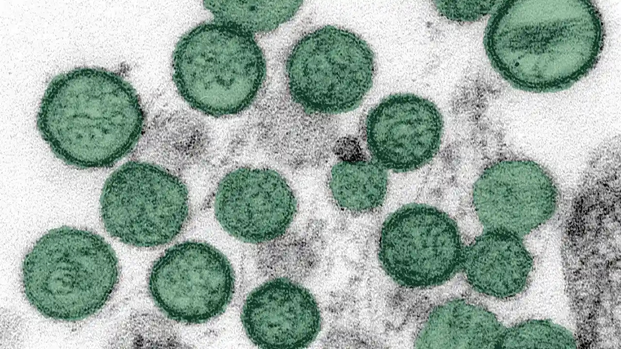 Brote de Hantavirus en Colombia: qué es, contagio, riesgos y dónde están los primeros casos