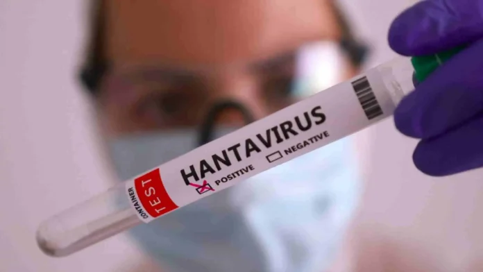 Hantavirus: ¿cuántos contagios van? Este y más detalles